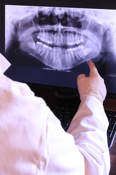 Best Emergency Root Canal Therapy in Washington, GA