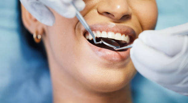 Best Emergency Wisdom Tooth Extraction in Washington, GA